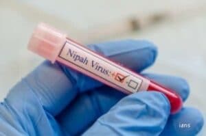 US scientists develop Nipah virus vax that can save lives in just 3 days