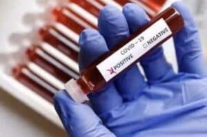 Covid 19 tally rises to 31 332 in India  1007 deaths