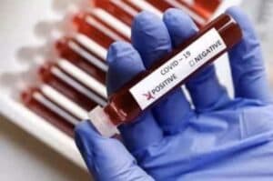 Record spike of over 55K coronavirus cases