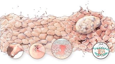 Australian-German Research Finds World-First Cure For Rare, Deadly Skin Disease