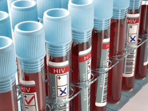 Global HIV Funding Cuts Can Cause Over 10 Mn Infections, 3 Mn Deaths by 2030: Lancet