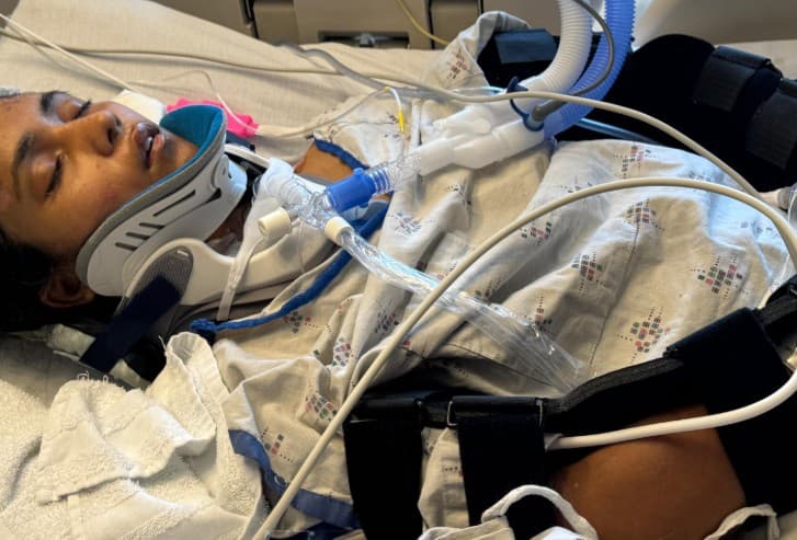 Indian Girl in Coma for Over a Month After San Jose Accident; Community Rallies Behind Family