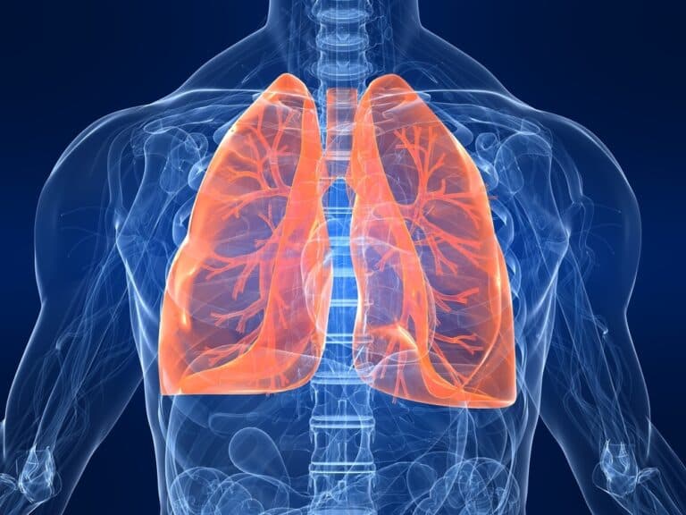 Why Are the Majority of Indians With Lung Cancer Nonsmokers?