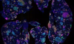 Study Finds Blood Marker That Could Detect Lung Cancer Risk Years in Advance