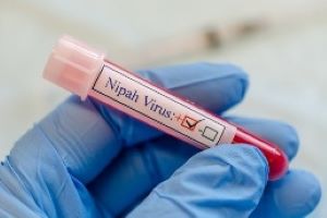 Vial with blood sample of label written Nipah Virus