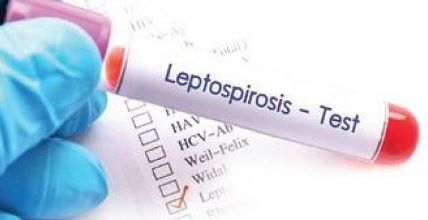 Leptospirosis, bacterial disease, bhagwant mann, animal fluid, urine