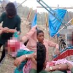 UP fair, Kannauj, Accident in Fair, Girl's Hair Entangled, Scalp Rip Off