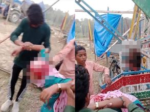 UP fair, Kannauj, Accident in Fair, Girl's Hair Entangled, Scalp Rip Off